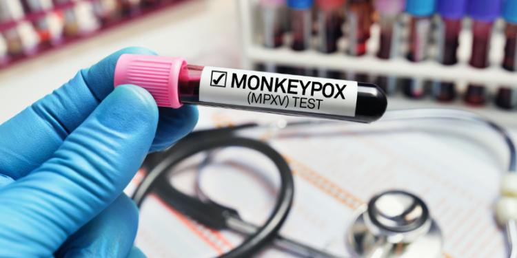Understanding Monkeypox – Education, Prevention, and Harm Reduction Are Key