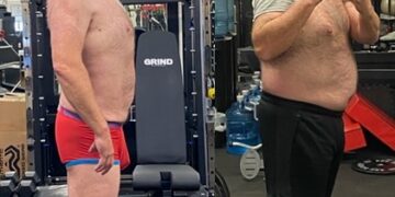 Being Obese Just No Fun… 